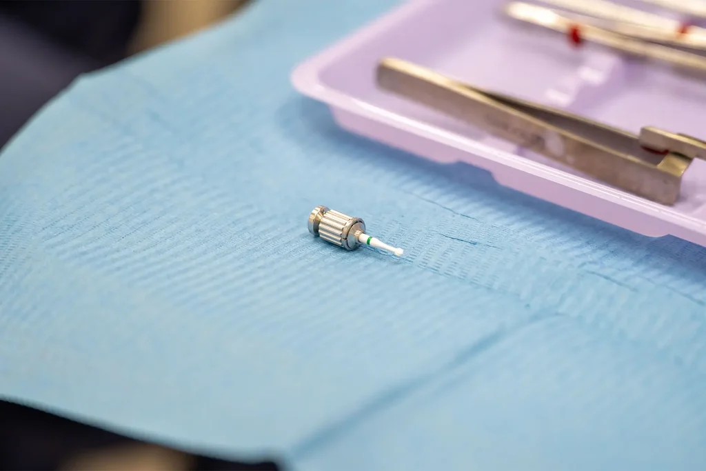 Endodonzia Pelagalli