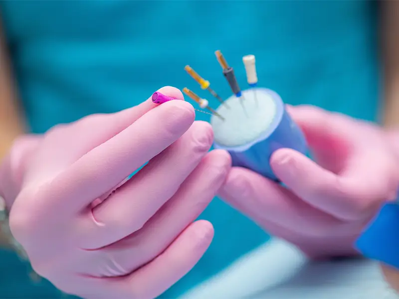 Endodonzia - Pelagalli