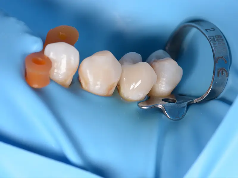 Pelagalli - Conservativa