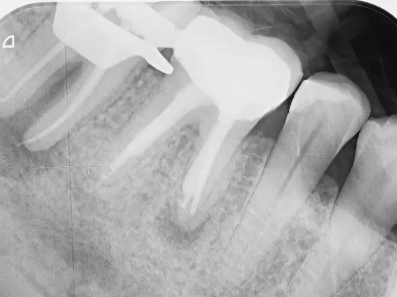 Pelagalli - Conservativa