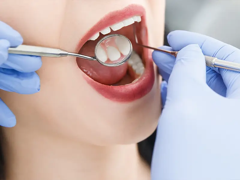 Pelagalli - Igiene orale