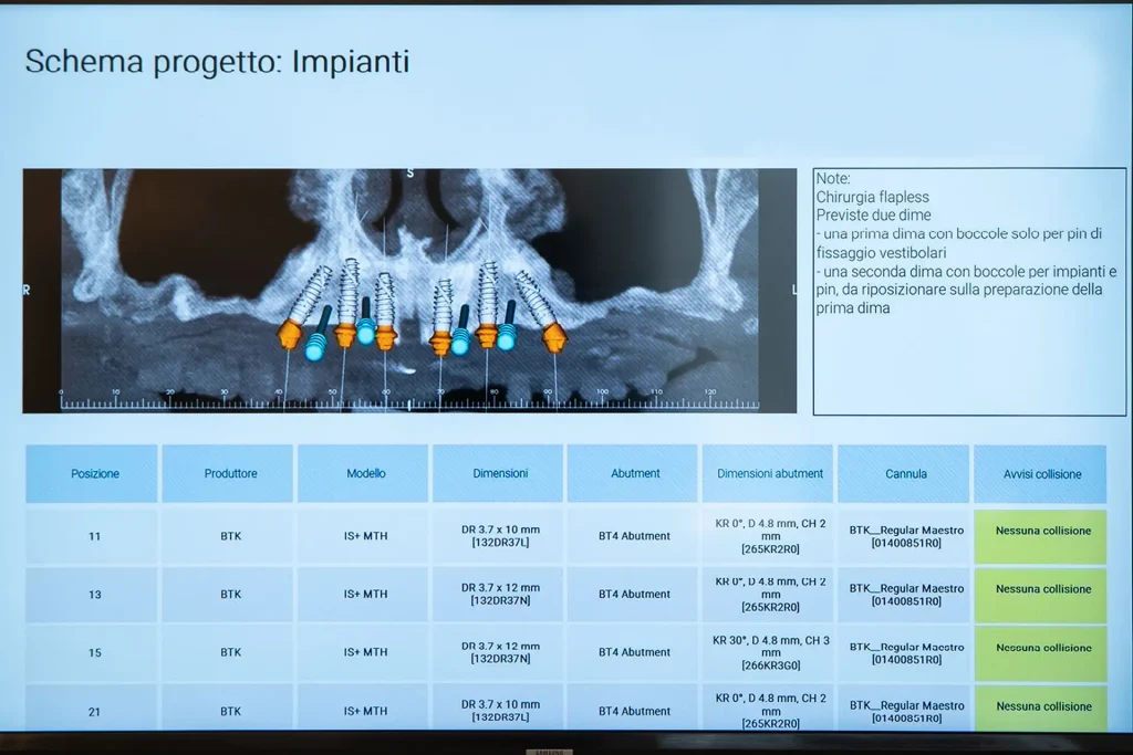 Impianti dentali - Pelagalli
