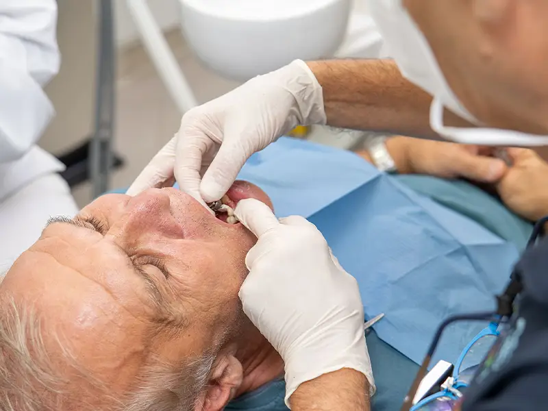 Pelagalli - Impianti dentali